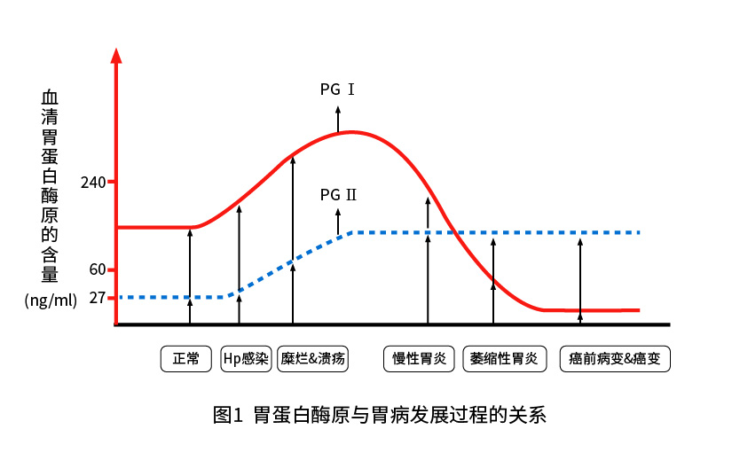 胃蛋白酶原Ⅰ（PGⅠ）和胃蛋白酶原Ⅱ（PGⅡ）與胃部疾病的關(guān)系