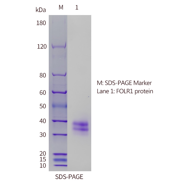 FBP SDS-PAGE